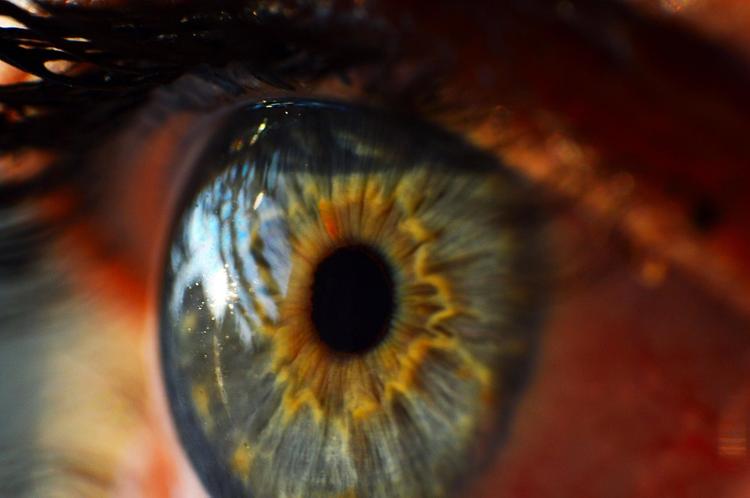 Три старушки из США ослепли после лечения зрения стволовыми клетками