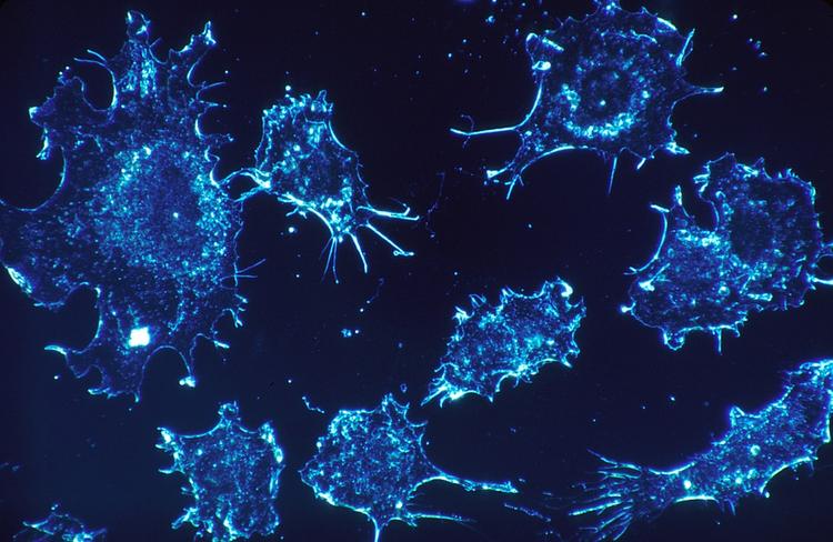 В Австралии разработали вещество, способное "усыпить" раковые клетки