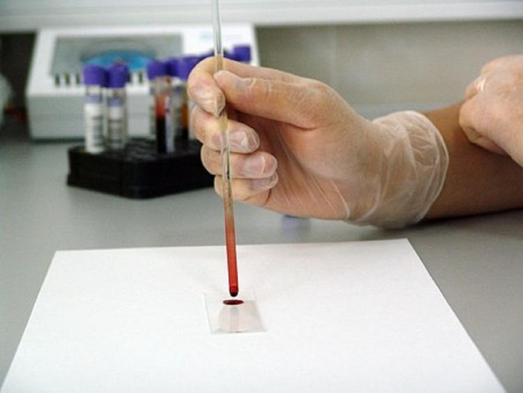 Новый метод анализа крови поможет диагностировать рак