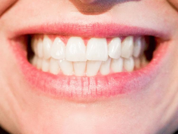 Зубная нить может оказаться опасной для здоровья