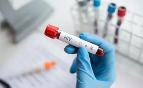 Когда у анализа на ВИЧ ложный результат?