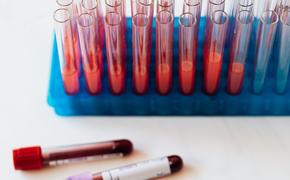  Шведские ученые нашли связь между серьезными заболеваниями и группой крови