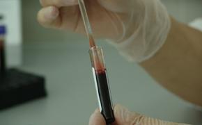  Врач Арвинд Кумар сообщил, что вакцина может превратить серьезное течение заболевания штаммом «дельта» в легкое