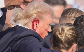 Трамп: простреленное ухо и стальные шарики. Куда мир на них покатится?