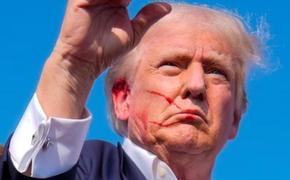 Трамп собою протестировал наличие американских психопатических убийц-юношей