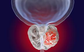 Когда рак свистнет