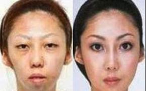 Китаец отсудил у жены 120 тысяч долларов за уродливых детей