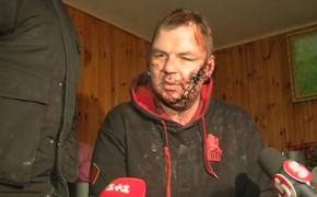 Избитый лидер "автомайдана" прилетел на лечение в Литву