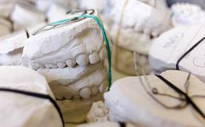 Ученые изобрели антибактериальные зубные импланты и распечатали их на принтере