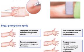 «Смерть шестилетней девочки в туберкулезном диспансере стала шоком для нас»