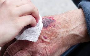 Осужденный паралимпиец Писториус попал в больницу с ранами на запястьях
