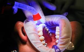 Изобретен щадящий и эффективный метод  отбеливания зубов