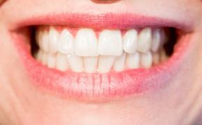 Ученые обнаружили фрукт, способный защитить зубы от кариеса