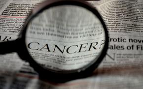 Ученые выявили признак скорого появления рака